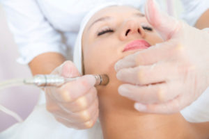 Microdermabrasion - Bellissimo Plastic Surgery